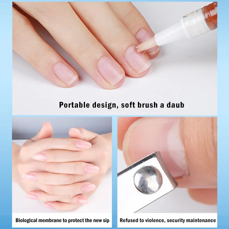 slefuirea ciupercii unghiilor dacă unghia doare de la ciuperca unghiei